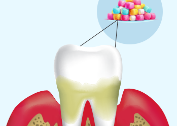 Chewing Gum: How It Affects Your Teeth and Gums